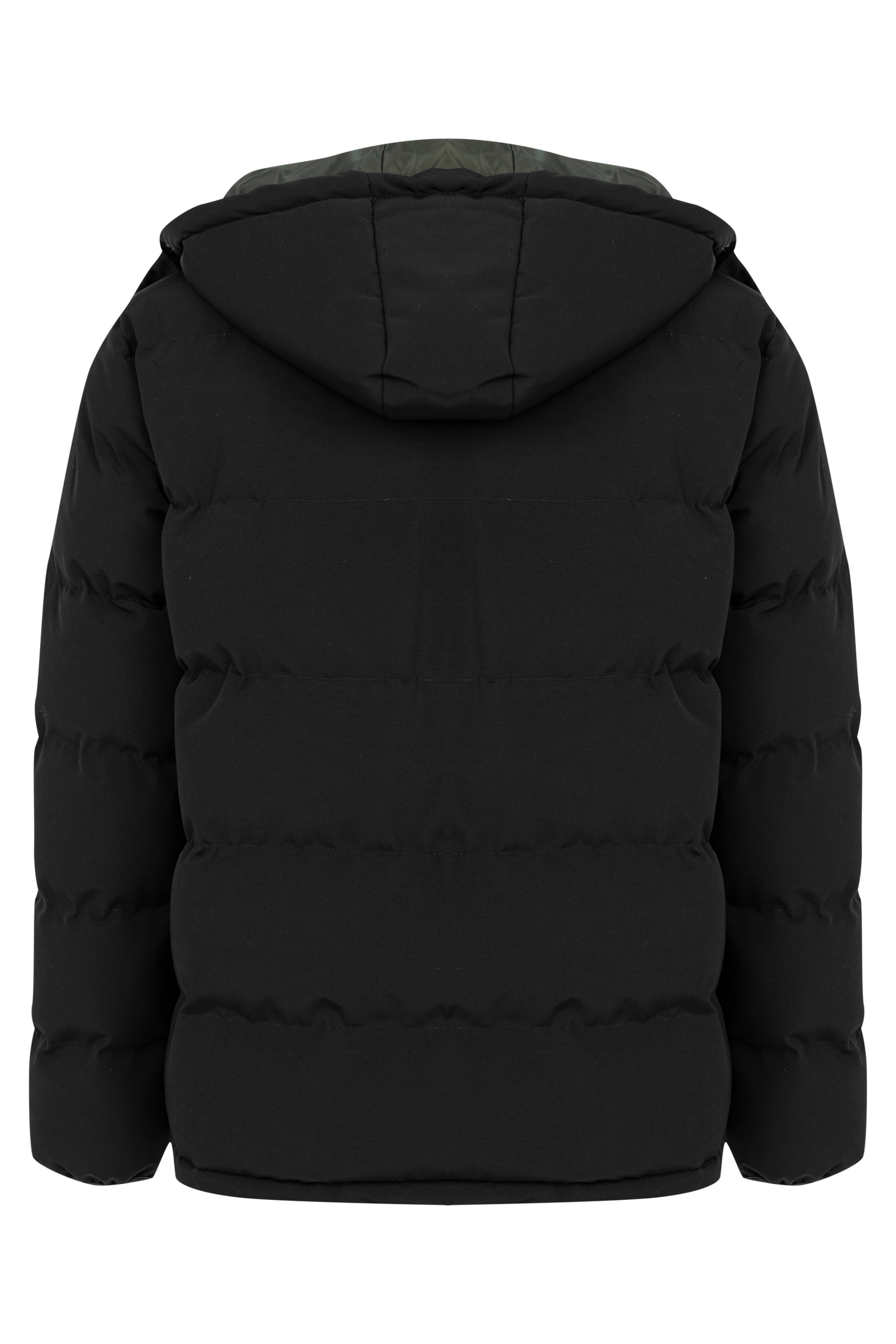 ÇIKARILABİLİR KAPÜŞONLU MONT